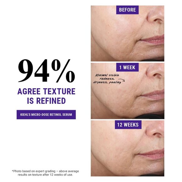 NEW Kiehl's Since 1851 Micro-Dose Anti-Aging Retinol Serum 1.7 oz./100%AUTHENTIC - Picture 5 of 8